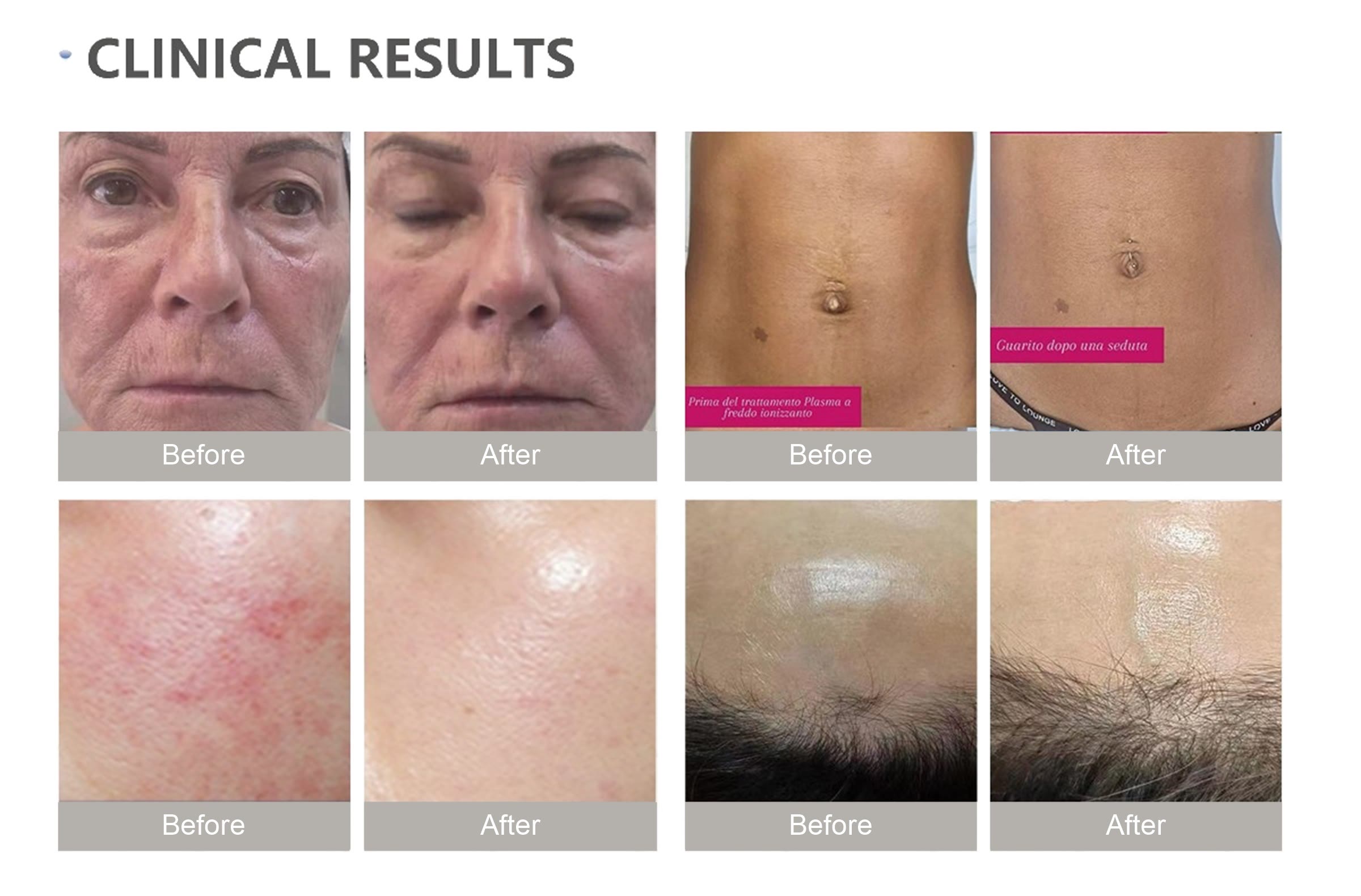 Before & after reference material